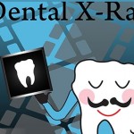 Four Common Myths About Dental X-rays