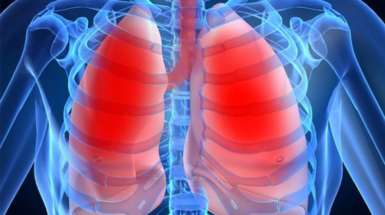 防治肺癌有道　低剂量CT及早揪病灶