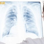 肺癌新一代化疗药物副作用少　医嘱性高提升疗效