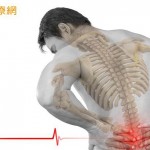 高频热凝神经阻断术　治疗慢性下背痛效果有限