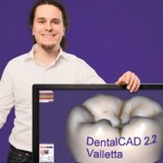 exocad发布新DentalCAD 2.2 Valletta 进行公司史上最大功能扩展
