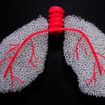 关于肺癌，你最想知道的５件事