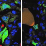癌症细胞有可能转换成无害细胞？