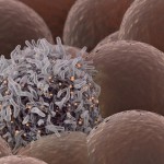 科学家研发出可消灭癌细胞的激光了？！