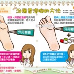 治療香港腳的方法