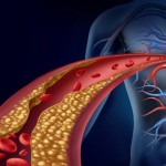 吃什麼可以降膽固醇、三酸甘油脂？魚油/藻油有降血脂功效嗎？專家統整高血脂症狀/治療/飲食/健康食品推薦！ ( 2019-2020 品牌、保健食品 ptt 整理)