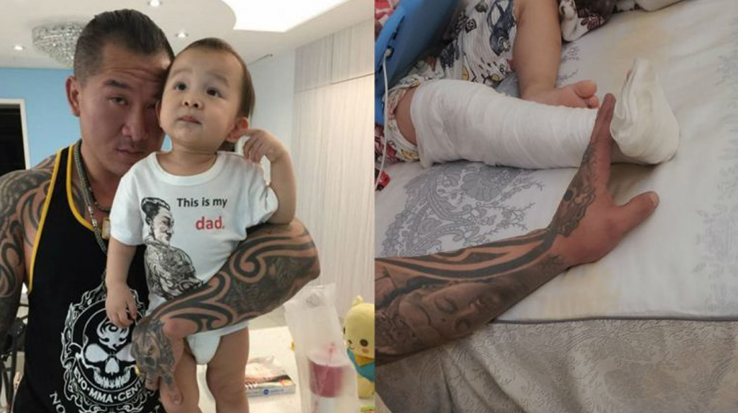 館長4歲兒「斷腿」真相反轉！當保母失職，你會選擇原諒嗎？