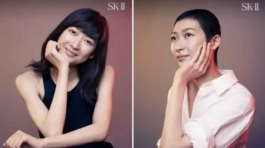 【我是游泳運動員，也是血癌倖存者】池江璃花子拿下假髮：「現在我只想做真實的自己。」