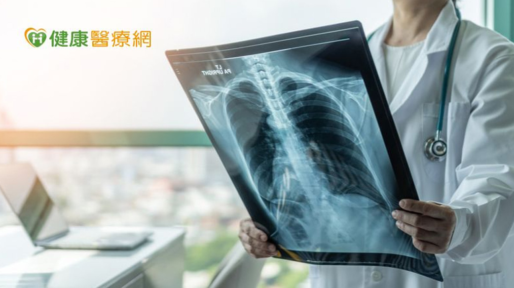 莫名喘咳竟是晚期小細胞肺癌　免疫組合治療燃生機