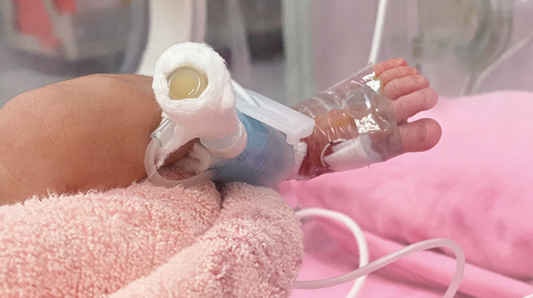 「再不剖就來不及了！到時要救媽媽還是救小孩？｣ 子癇前症媽媽，心有餘悸的產前產後21天