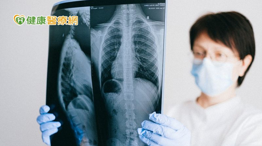 選標靶還是免疫？　個人化精準醫療掌握肺癌治療先機