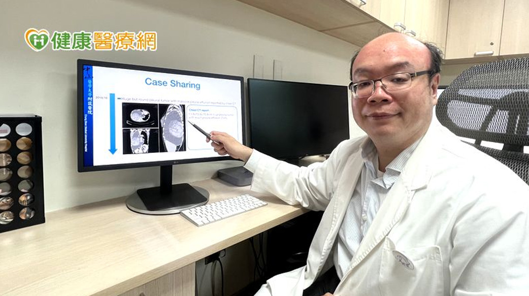 久咳誤認得新冠　竟是手球大的惡性腫瘤在作祟