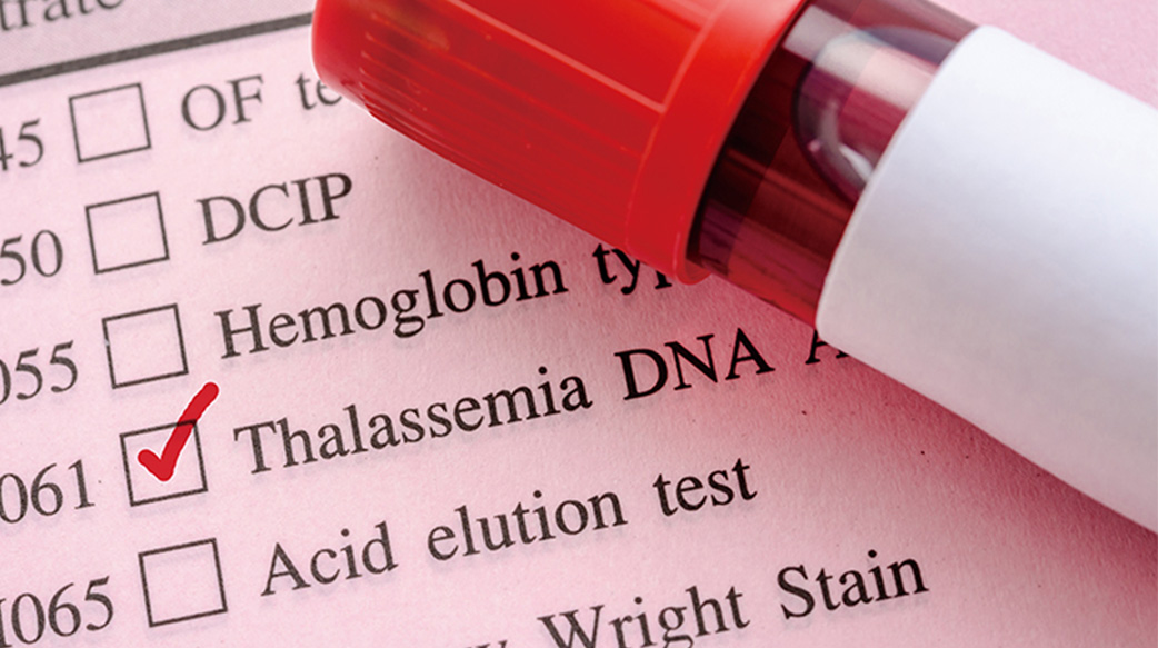 孕前產前篩檢海洋性貧血，預防重症為首要目標！