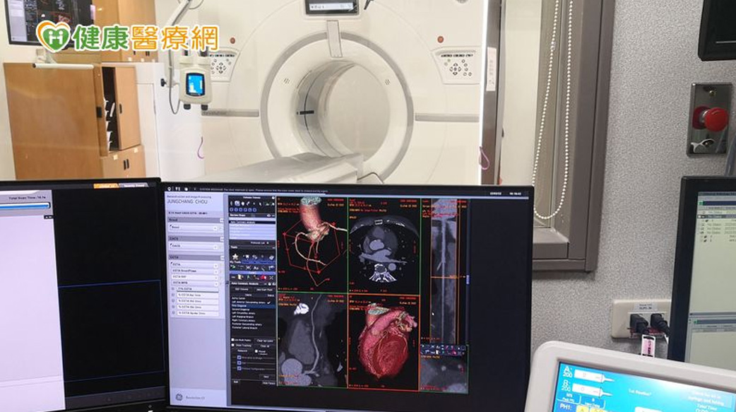 為了避免心肌梗塞或猝死， 應了解「這個檢查」！