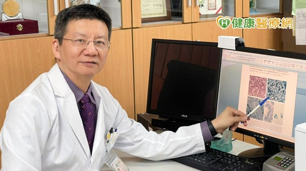 蛋白尿以為腎病　竟是罕見疾病上身！