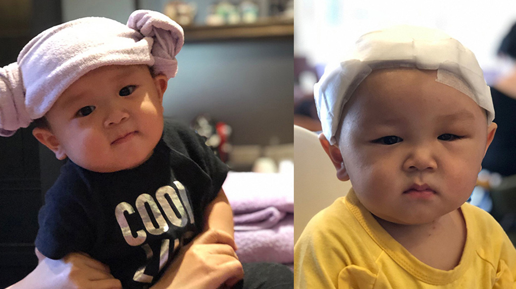 孩子患顱縫早閉、腦瘤，在「三萬分之一的機率中」全家因此遇見神！