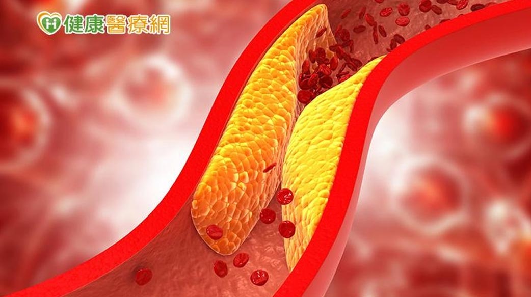 膽固醇過高就不健康嗎？醫：「低密度脂蛋白」數值才是關鍵！