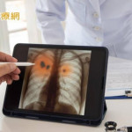 領先國際！　臺灣7月啟動LDCT肺癌篩檢