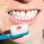 刷牙就流血當心變「無齒」　醫揪2元兇