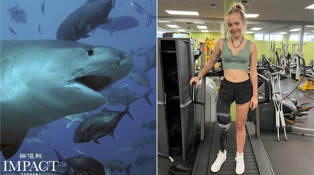 17歲啦啦隊長遭鯊魚偷襲慘被截肢 開朗少女今倚靠上帝和眾人愛心 樂觀走康復路