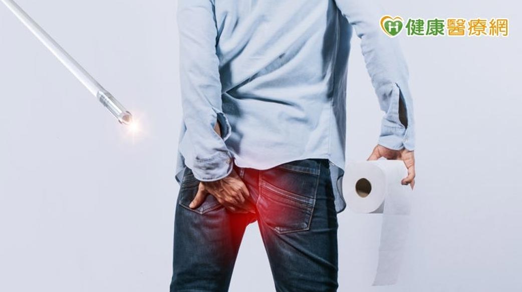 開痔瘡未必得住院　大腸直腸外科醫師解析新式LHP微創雷射痔瘡消融術