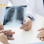 肺癌死亡率高居第一！　權威醫籲治療前先了解「3件事」