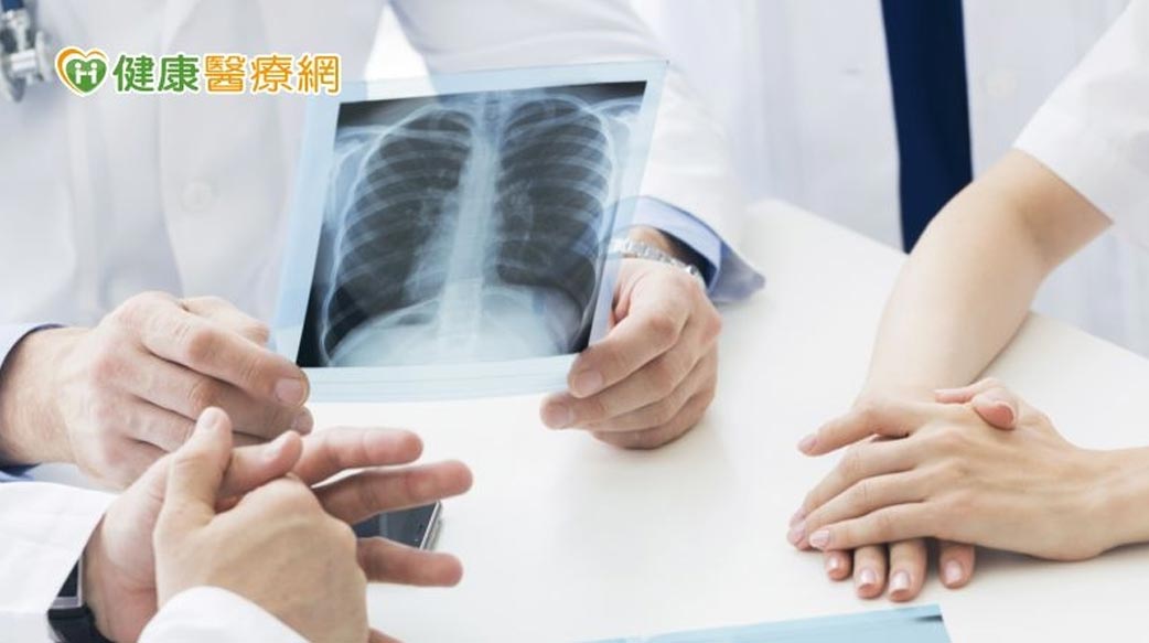 肺癌死亡率高居第一！　權威醫籲治療前先了解「3件事」