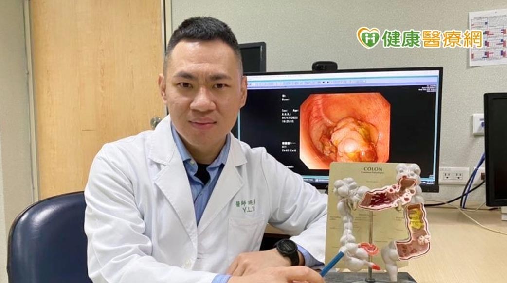 8旬翁肚子痛竟大腸癌第四期　醫曝大腸癌危險族群