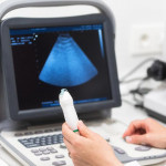 AI检测乳癌正确率帮助大增