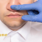 車禍撞擊、球K到導致鼻子變形有救嗎？　醫師QA一次看
