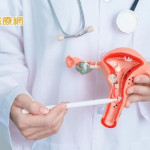 HPV疫苗安全嗎？接種就可100%預防子宮頸癌？　常見3QA一次看！