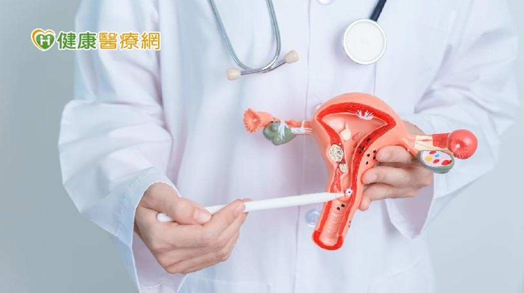 HPV疫苗安全嗎？接種就可100%預防子宮頸癌？　常見3QA一次看！