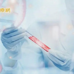 胸口悶以為長新冠竟是急性血癌　最新指引助精準治療改善預後