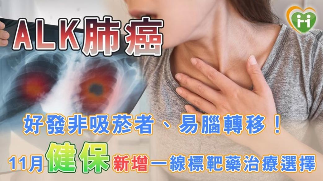 ALK肺癌好發非吸菸者、易腦轉移！　11月健保新增一線標靶藥治療選擇
