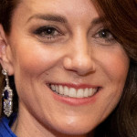 凱特王妃怎麼了？