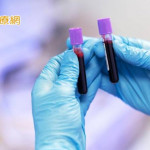 肺癌篩檢再突破！三總聯手旌德生技研發新技術助早期發現癌變