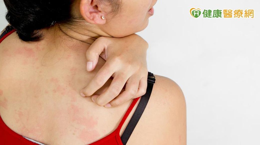 更年期皮膚癢不停難入睡　何首烏滋腎茶緩解更年期不適