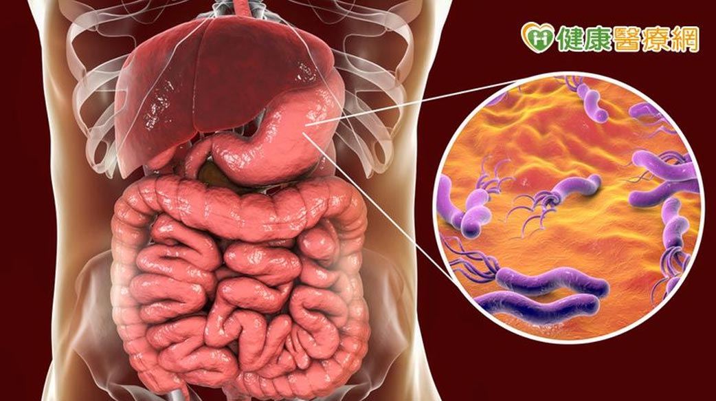 常腹脹、打嗝小心潛藏癌症風險　研究：國人感染盛行率為3成