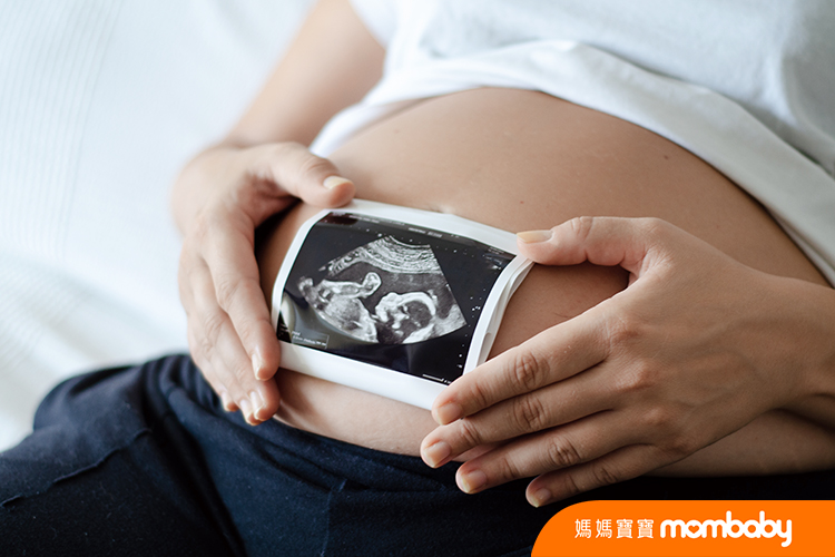 Pregnant,Woman,Holding,An,Ultrasound,Image,Of,The,Baby.,Close-up
