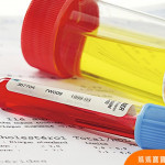 了解孕期常見泌尿道系統7問題，從補充足夠水分開始，遠離感染找上身