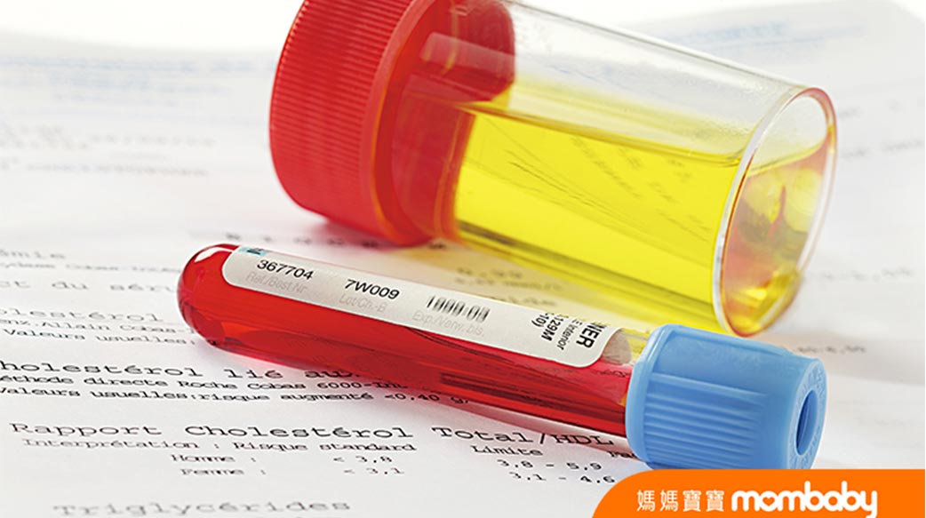 了解孕期常見泌尿道系統7問題，從補充足夠水分開始，遠離感染找上身