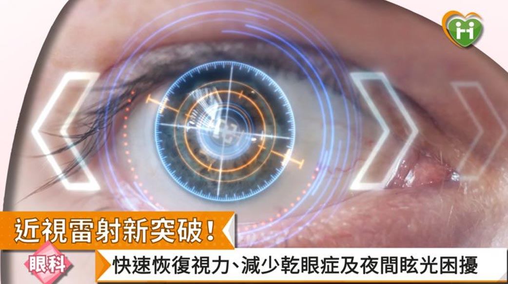 近視雷射新突破！快速恢復視力、減少乾眼症及夜間眩光困擾