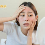 夏天臉紅通通可能是酒糟肌！　醫師分享護膚指南告別泛紅、痘痘
