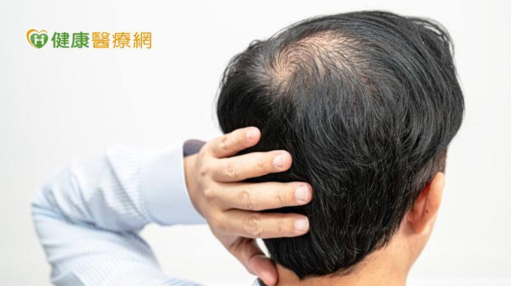 全台360萬落髮患者新福音！國際新型AMT自體微移植技術挽救毛髮健康
