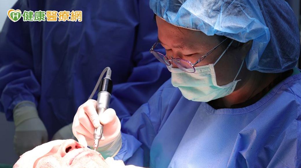 大範圍深層痘疤如何消？　醫：選擇機械磨皮術