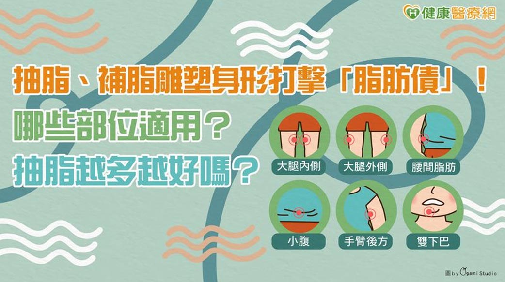 抽脂、補脂雕塑身形打擊「脂肪債」！　哪些部位適用？抽脂越多越好嗎？