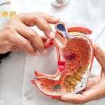 胃癌約9成是「幽門桿菌」所致！護胃健康有5招　今年篩檢擴大試辦17縣市