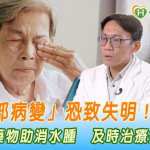 「黃斑部病變」恐致失明！雙機轉藥物助消水腫　及時治療搶救視力
