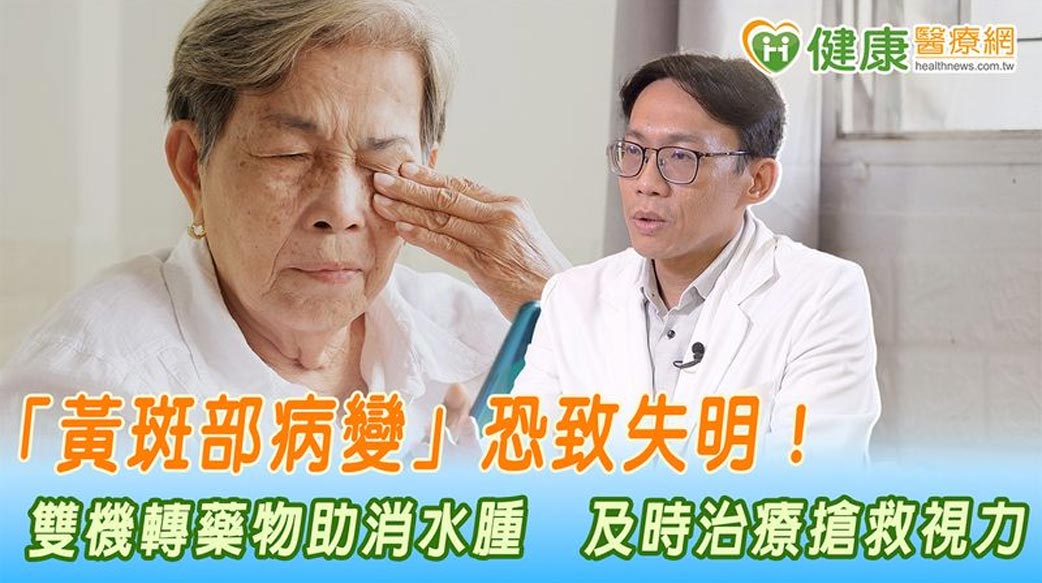 「黃斑部病變」恐致失明！雙機轉藥物助消水腫　及時治療搶救視力