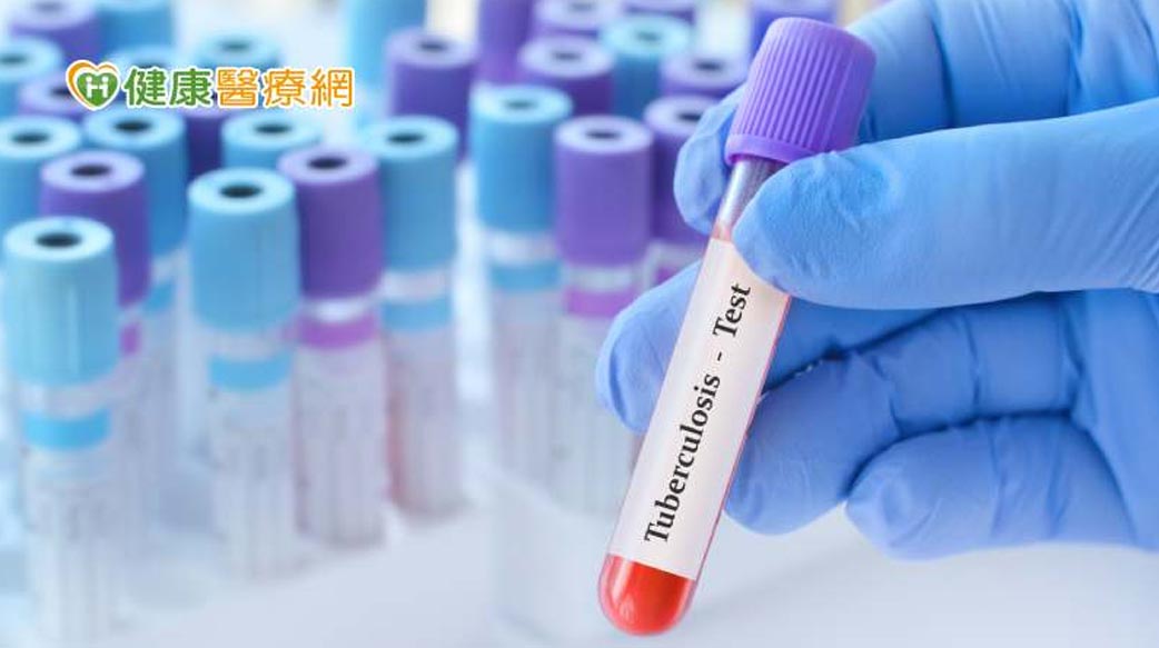 預防結核病從篩檢、治療做起！　完成LTBI檢驗、治療還有機會抽大獎
